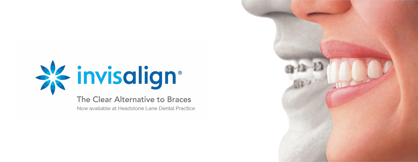Invisalign Braces at headstone lane dental practice