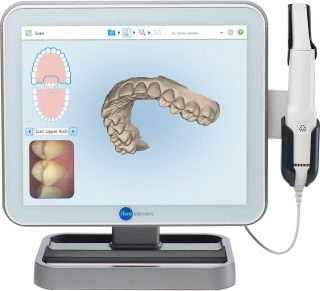 Itero scanner at headstone lane dental in harrow